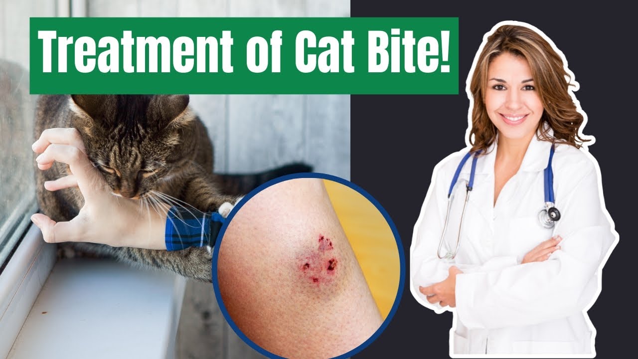 How to Clean a Cat Bite? | Cat Bite Emergency! The Lifesaving Hacks You Need to Know! | FrshHomeTalk