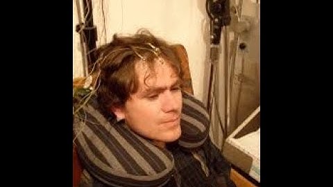 Electrocorticography CPT code - simplify medical coding