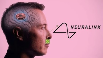 Neuralink Unveiled: Revolutionizing Brain-Machine Interfaces