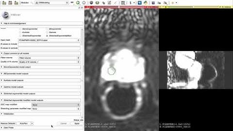 3D Slicer DWModeling demonstration