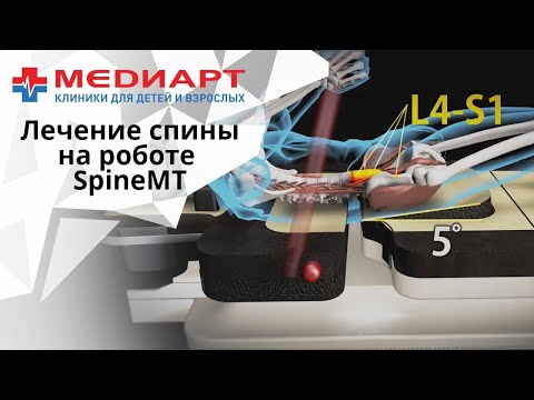 Мобилизация и декомпрессия позвоночника на роботе SpineMT K-1 в клинике МедиАрт