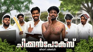 ചകകൻപകസ Comedy Short Sketch