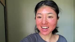 My first chemical peel experience  COSMELAN TREATMENT BY MESOESTETIC