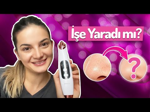 BİM’den 59,90 TL'ye siyah nokta temizleyici aldım 🥰 (Polosmart beauty)