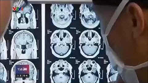 Tác hại của sóng điện thoại di động ảnh hưởng thế nào đến não bộ của chúng ta??!