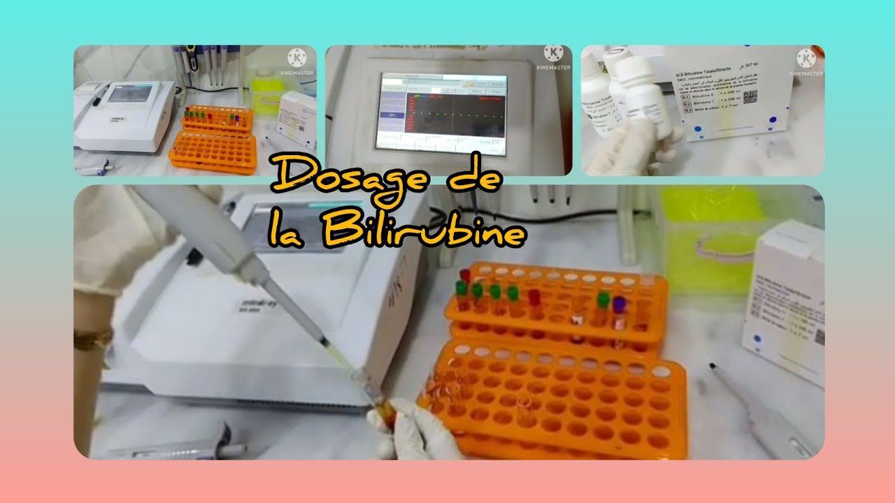 تحليل البليروبين/Dosage de la Bilirubine Totale et Bilirubine Directe