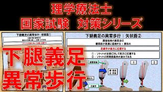 下腿義足の異常歩行　～No 125 理学療法士国家試験対策　シリーズ～