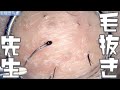 028 髭抜き Dr. tweezers 高倍率毛抜き Pull out