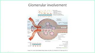 UofL Endocrinology Grand Rounds: Dr. Michael Merchant