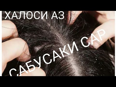 Сабусаки сар:халоси аз он.شوره سر.Как избавиться от перхоти