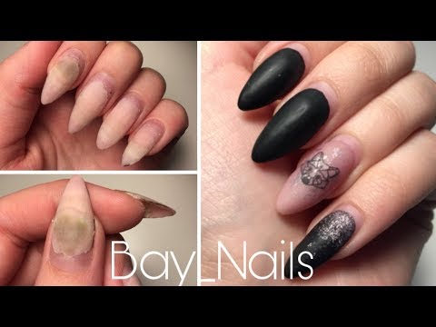 ПЛЕСЕНЬ НА НОГТЯХ?! Bay_Nails