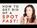 How To Get Rid Of A Spot FAST! | Dr Sam Bunting