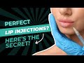 Lip Injection Techniques and Patient Consultation