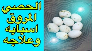 الحصي المروق في الحمام ومرض نقص الخصوبة واسباب حدوثه والوقاية والعلاج