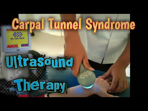 VIDEO 04: Terapi Ultrasound Nyeri Pergelangan Tangan || Carpal Tunnel Syndrome