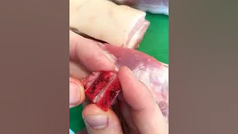 Что такое фасция?