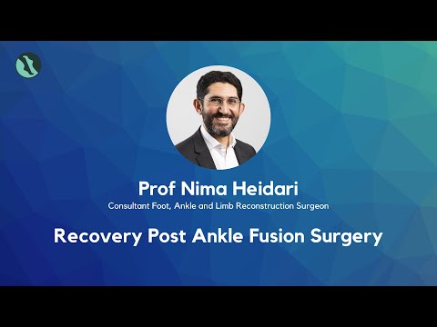 Recovery after ankle fusion surgery