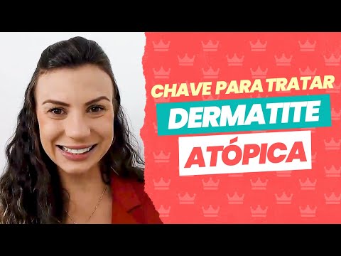 Vídeo: 15 maneiras de tratar o eczema facial