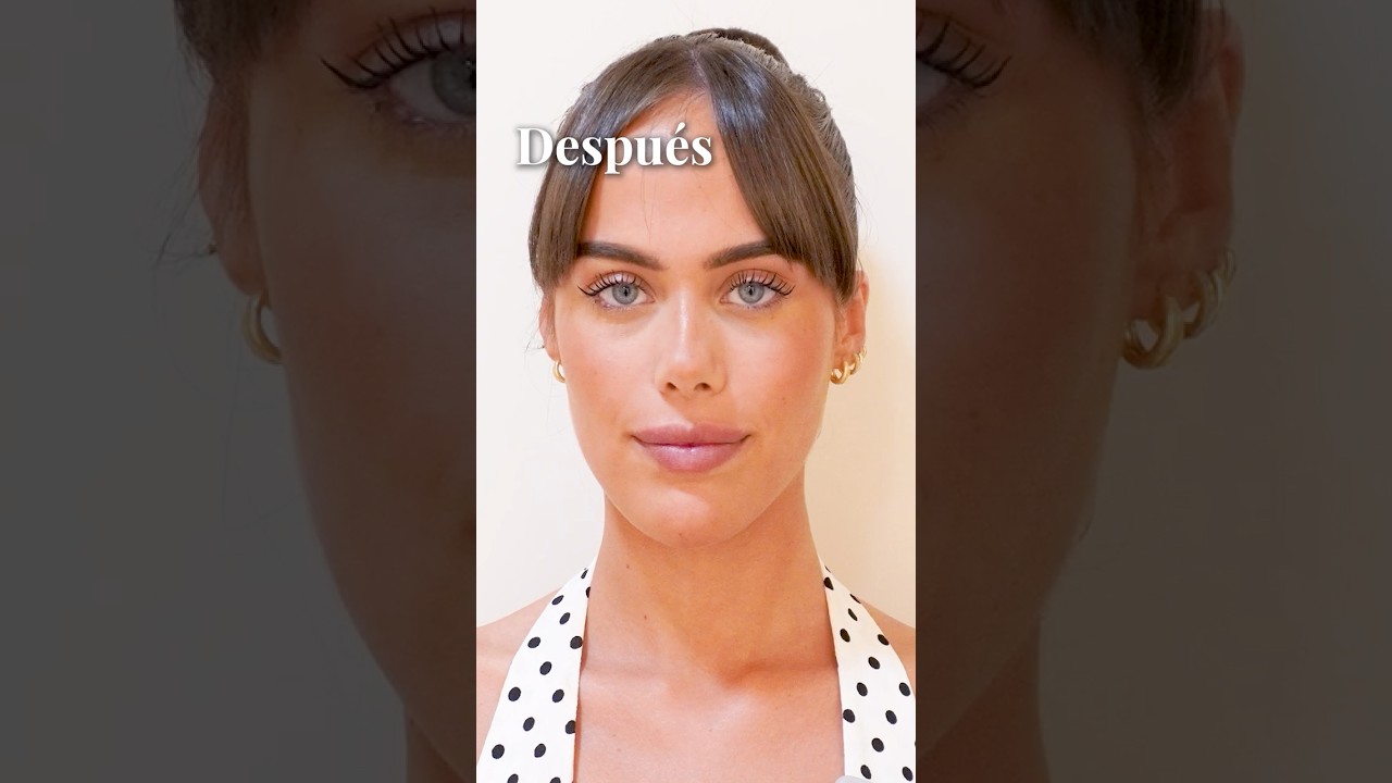 El resultado de la armonización facial de Andrea Canel ✨