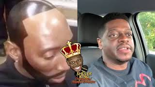 Shuler King - You’re Bald Brother. Accept it!!!