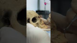 Did Ancient Egyptians Really Perform Brain Surgery?