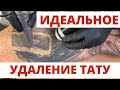 ИДЕАЛЬНОЕ УДАЛЕНИЕ ТАТУ лазером за 5 МЛН РУБЛЕЙ! ПРАВИЛЬНОЕ лазерное удаление.