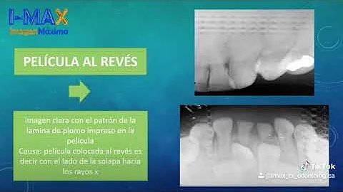 ¿Cometen errores los radiólogos?