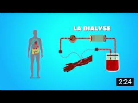 Vidéo: Pourquoi le glucose peut-il passer par la dialyse ?