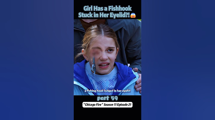 Girl Has a Fishhook Stuck in Her Eyelid?!😱【Part 59】