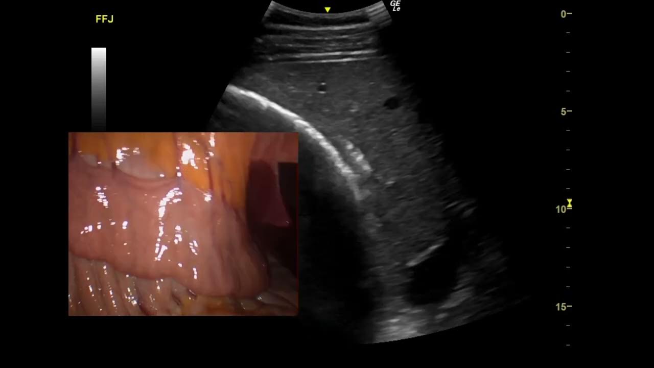 Equine Ultrasonography of Duodenum YouTube
