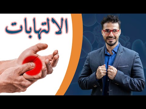 فيديو: هل تؤثر مضادات الالتهاب غير الستيرويدية على معدل التثفل؟