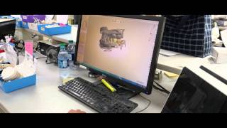 Should you invest in CAD CAM for your dental practice?