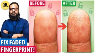 Recover Your Fingerprint! Improve Fingerprint Quality | Urdu/Hindi | Dr. Ibrahim screenshot 2