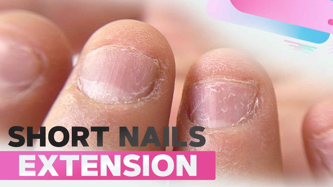 Short Nails Extension | Bitten Nails Transformation | Simple Glitter Nail  Art - YouTube