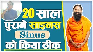 20 साल पुराने साइनस (Sinus) को किया ठीक || Swami Ramdev