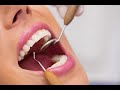 Професионална дентална фотография – Professional dental photography