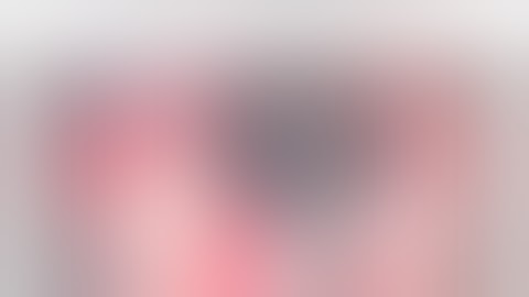 Steven Ma, MD - Manual Small Incision Cataract Surgery (MSICS): Relevance in the World