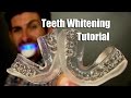 Achieve a Bright Smile at Home with Professional Teeth Whitening Kit