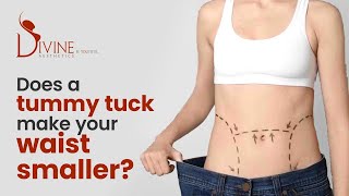 Does a Tummy Tuck Make Your Waist Smaller?
