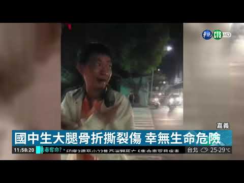 國中生遭校車拖行 大腿骨折血肉模糊 | 華視新聞 20181006