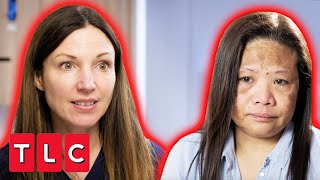 "I'm Scared Of My Face" Dr. Emma Helps Melasma Patient With Self-Esteem Issues | The Bad Skin Clinic