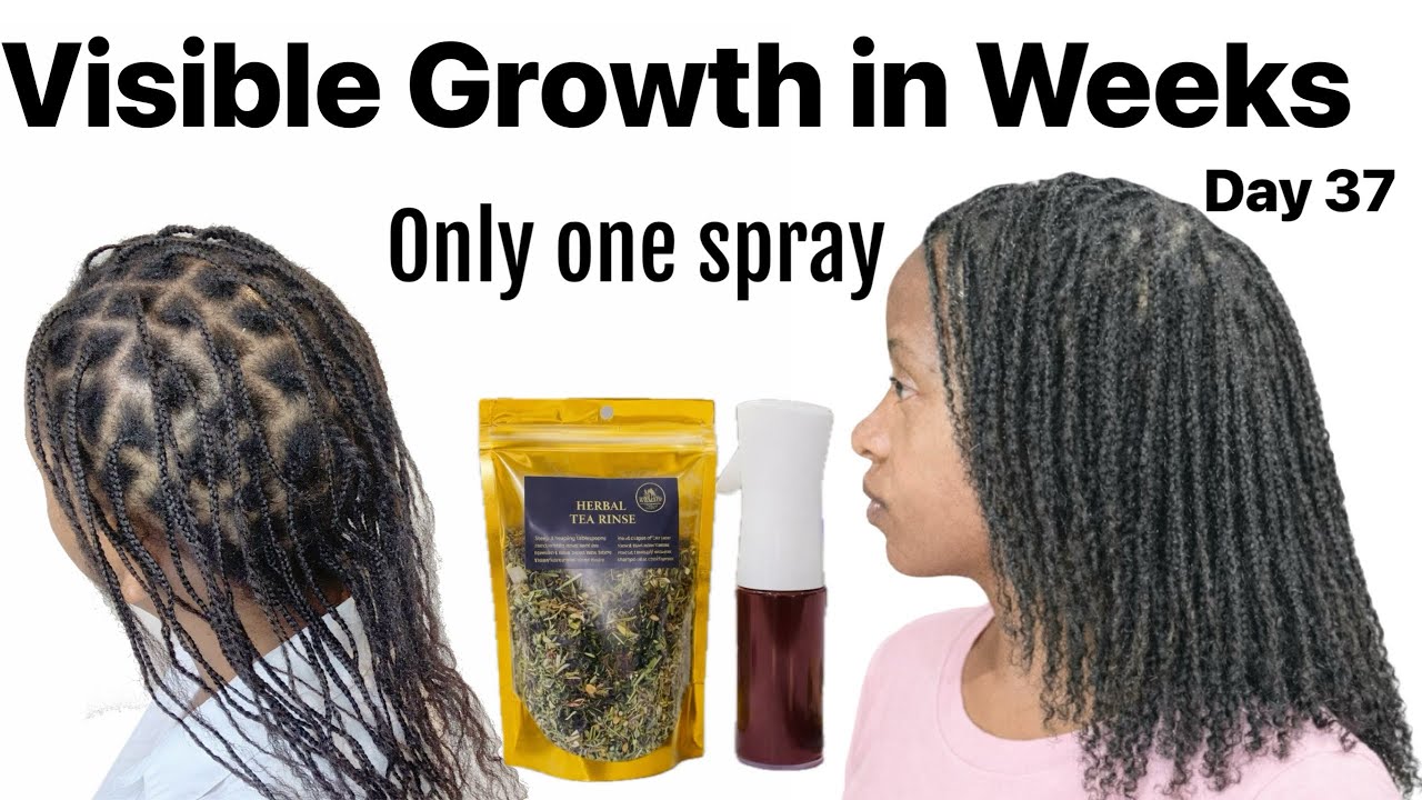 Не позволяйте им вас обманывать. Волосы могут отрасти за несколько недель. У меня так и случилось...