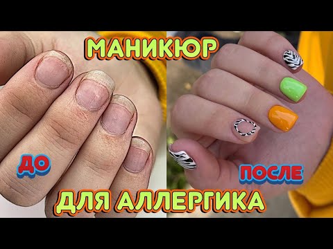 Маникюр при Аллергии на любое покрытие 💅 Гель лаки для аллергиков 💅 Красивые ногти