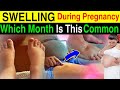 Which Month Swelling Is Common During Pregnancy 🫃