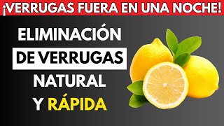 Remove Warts and Skin Tags Naturally in One Night – Easy and Fast