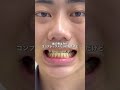 SNSで話題の歯磨き粉　口元の清潔感上がってめっちゃ良かった！　#歯 #ホワイトニング #歯磨き粉 #黄ばみ #清潔感 pr