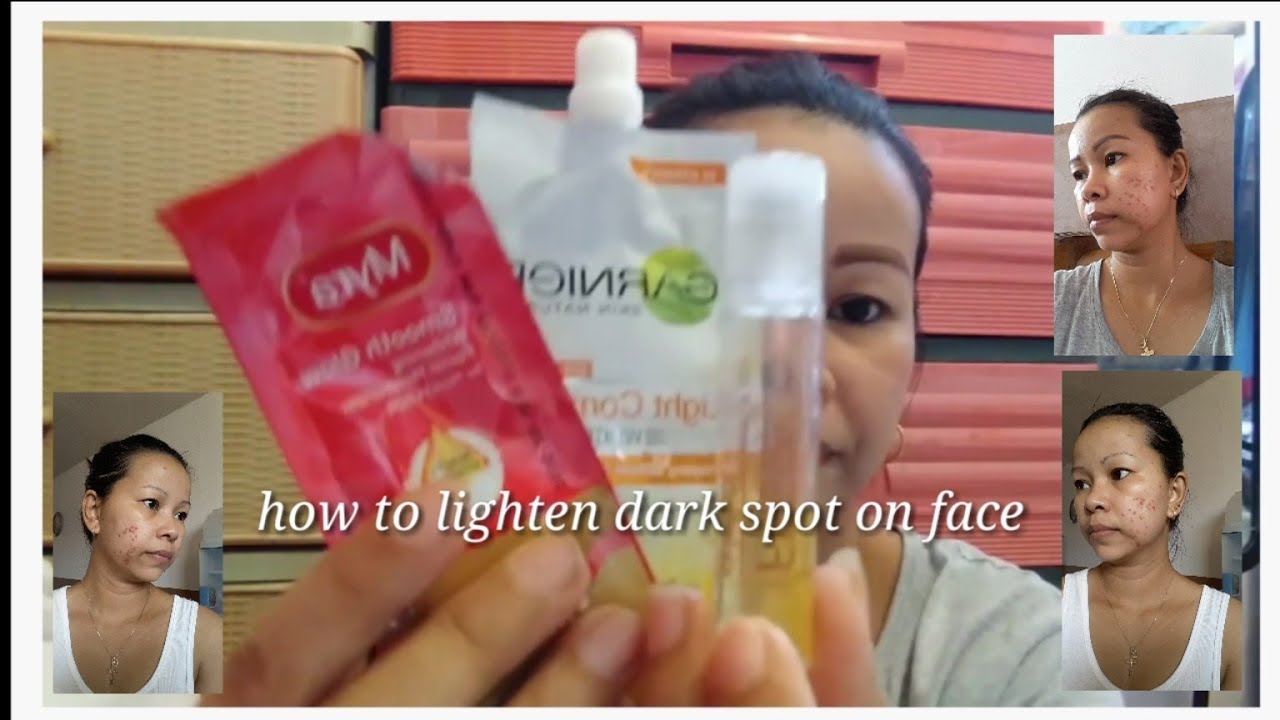 How to lighten dark spot on face YouTube
