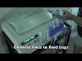 Peritoneal Dialysis with Baxter HomeChoice Automated Cycler machine