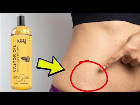 Video: Minyak Kastor: Ubat Stretch Marks Atau Pelembap Lain?