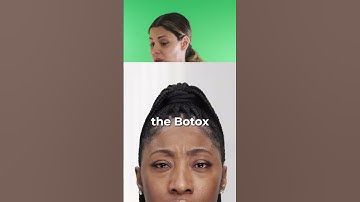 How Long Does BOTOX® Last? - The Langdon Center